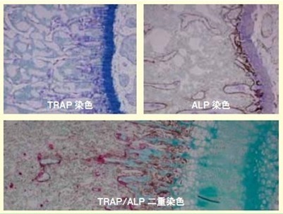 用于石蜡切片的骨相关酶trapalp的双重染色法