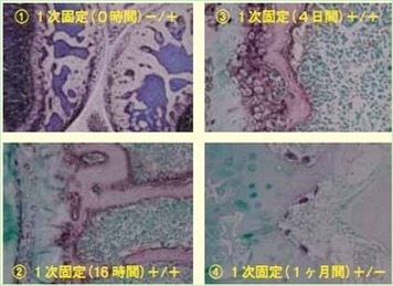 用于石蜡切片的骨相关酶trapalp的双重染色法